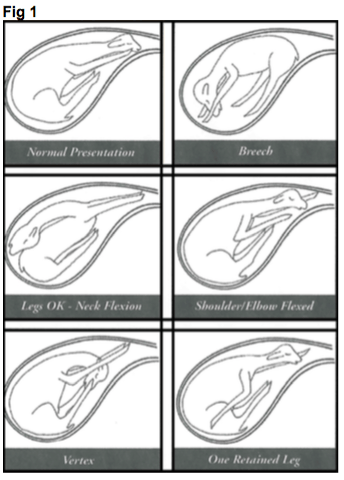 Six drawings of a cria in the womb: normal presentation, breech, legs OK with neck flexion, shoulder or elbow flexed, vertex, and one retained leg